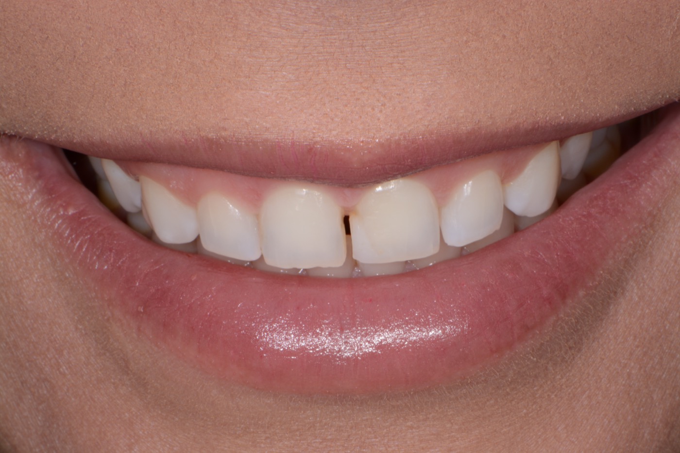 Case 1 before photo 1