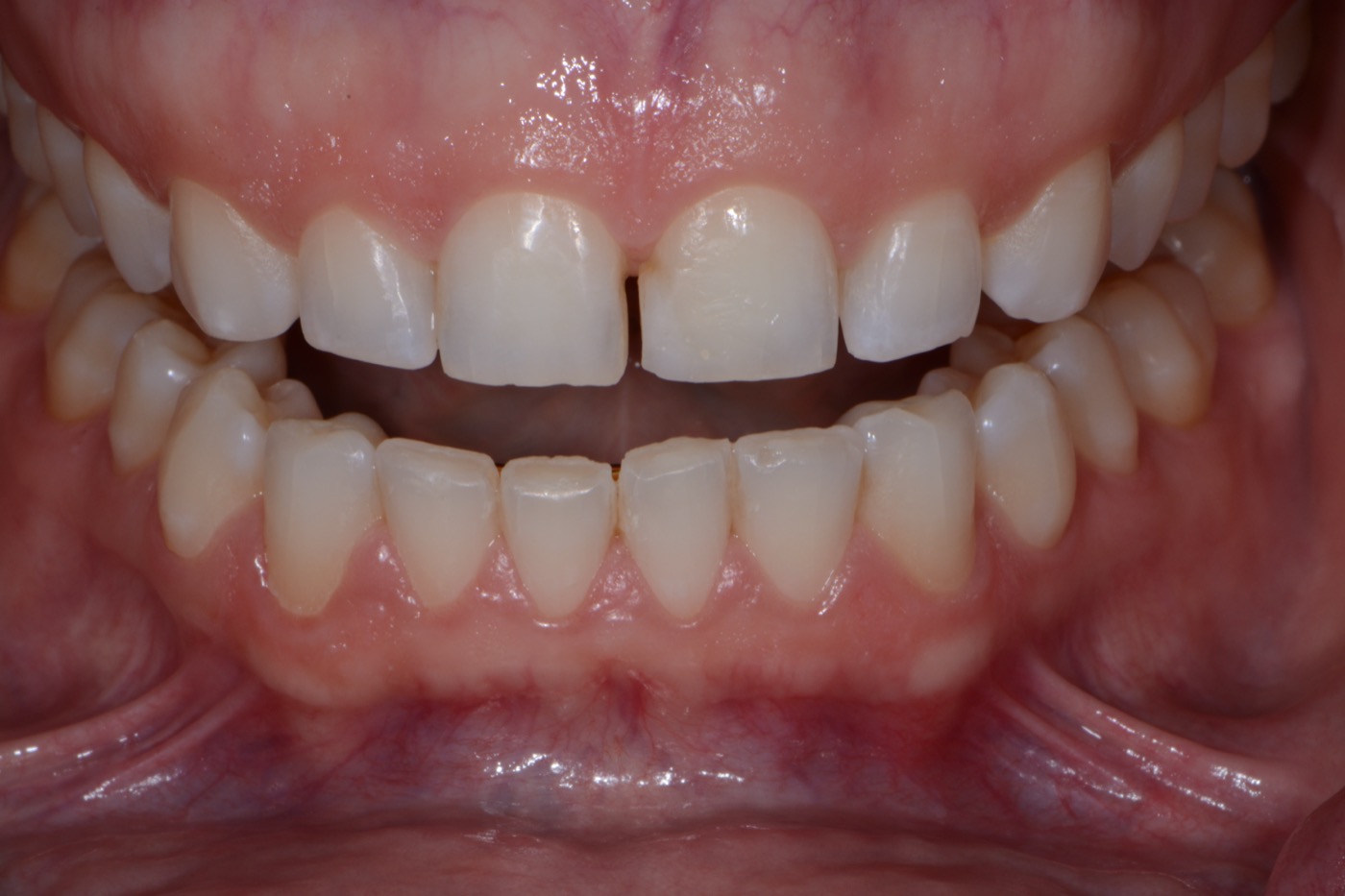 Case 1 before photo 2