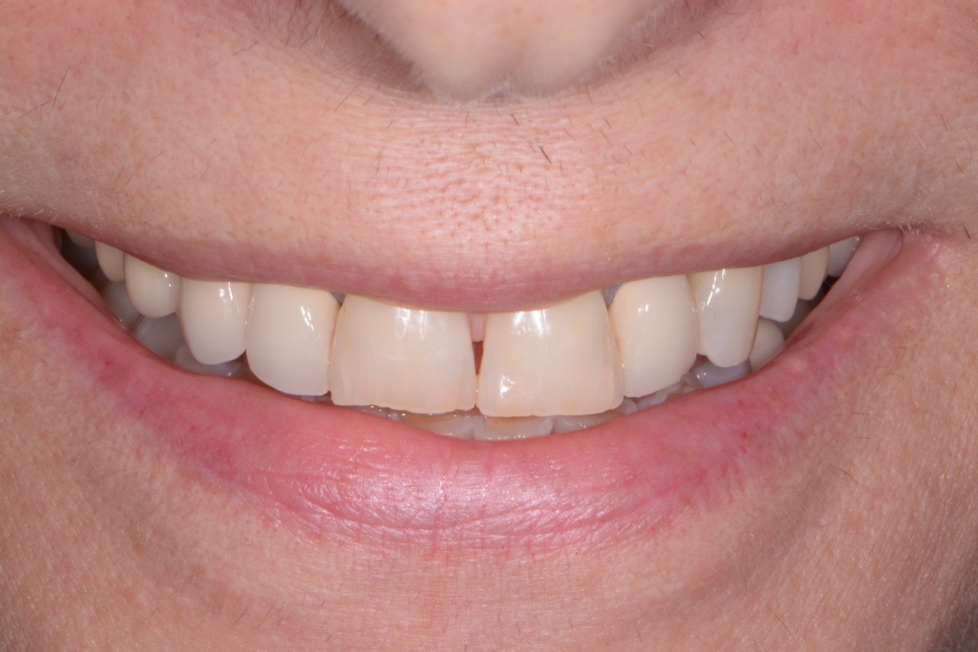 Case 3 before photo 1