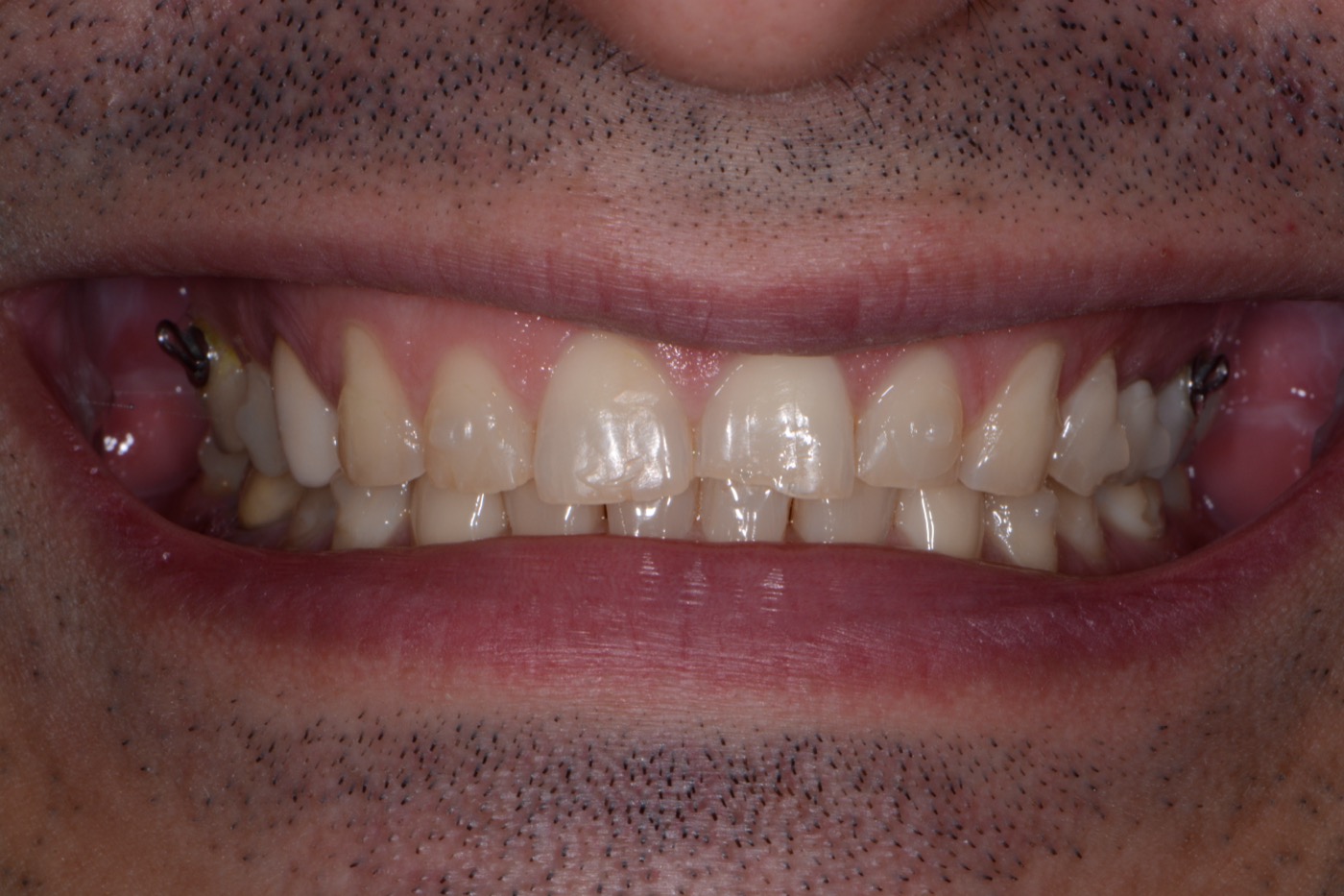 Case 5 before photo 1