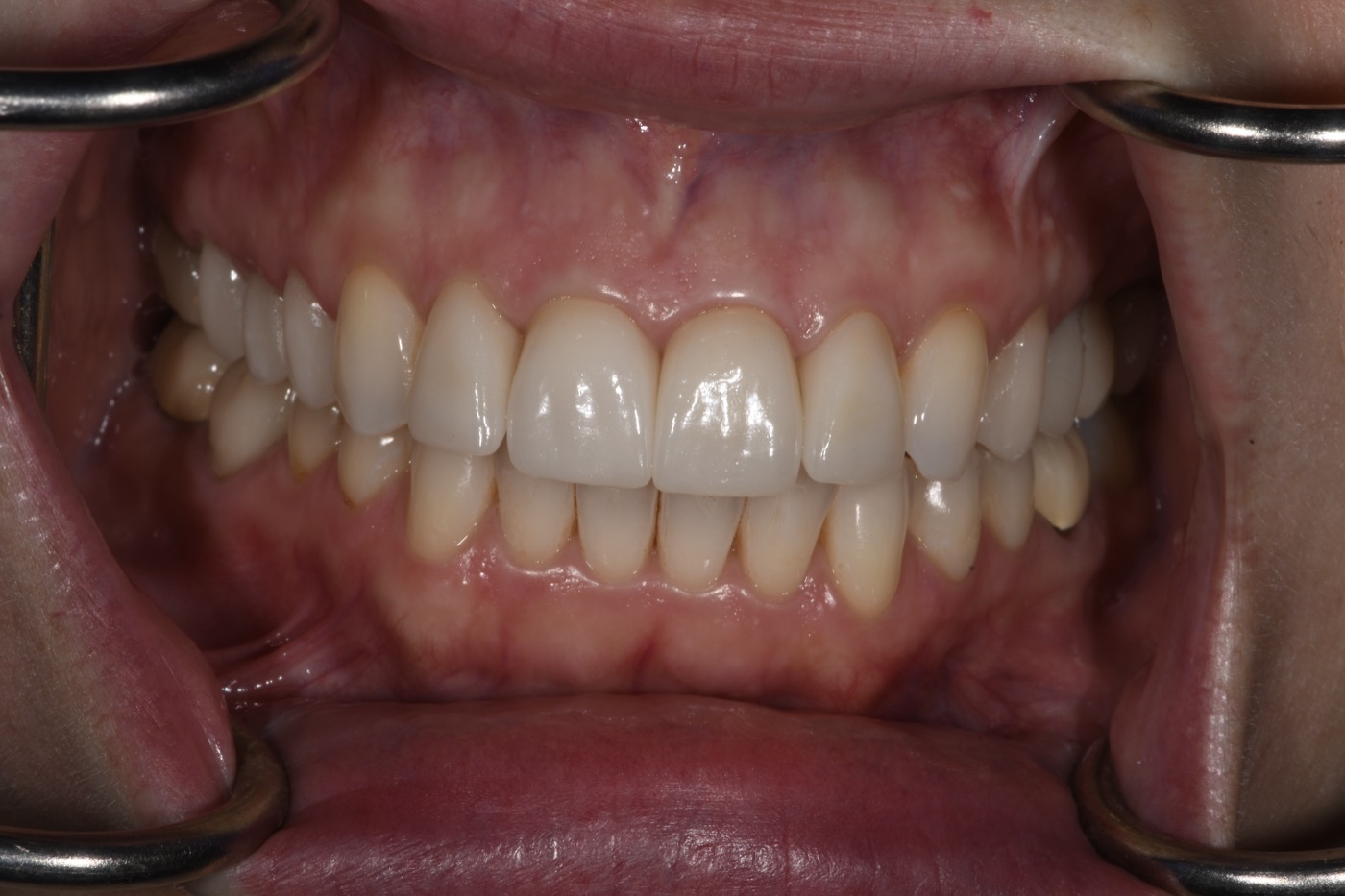 Case 7 after photo 2