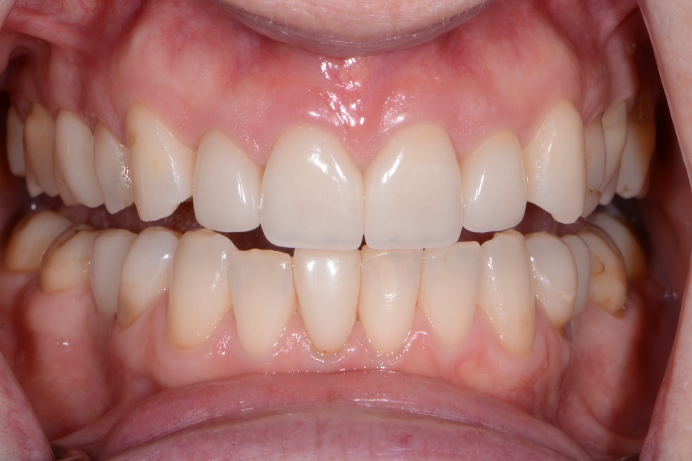 Case 8 after photo 2