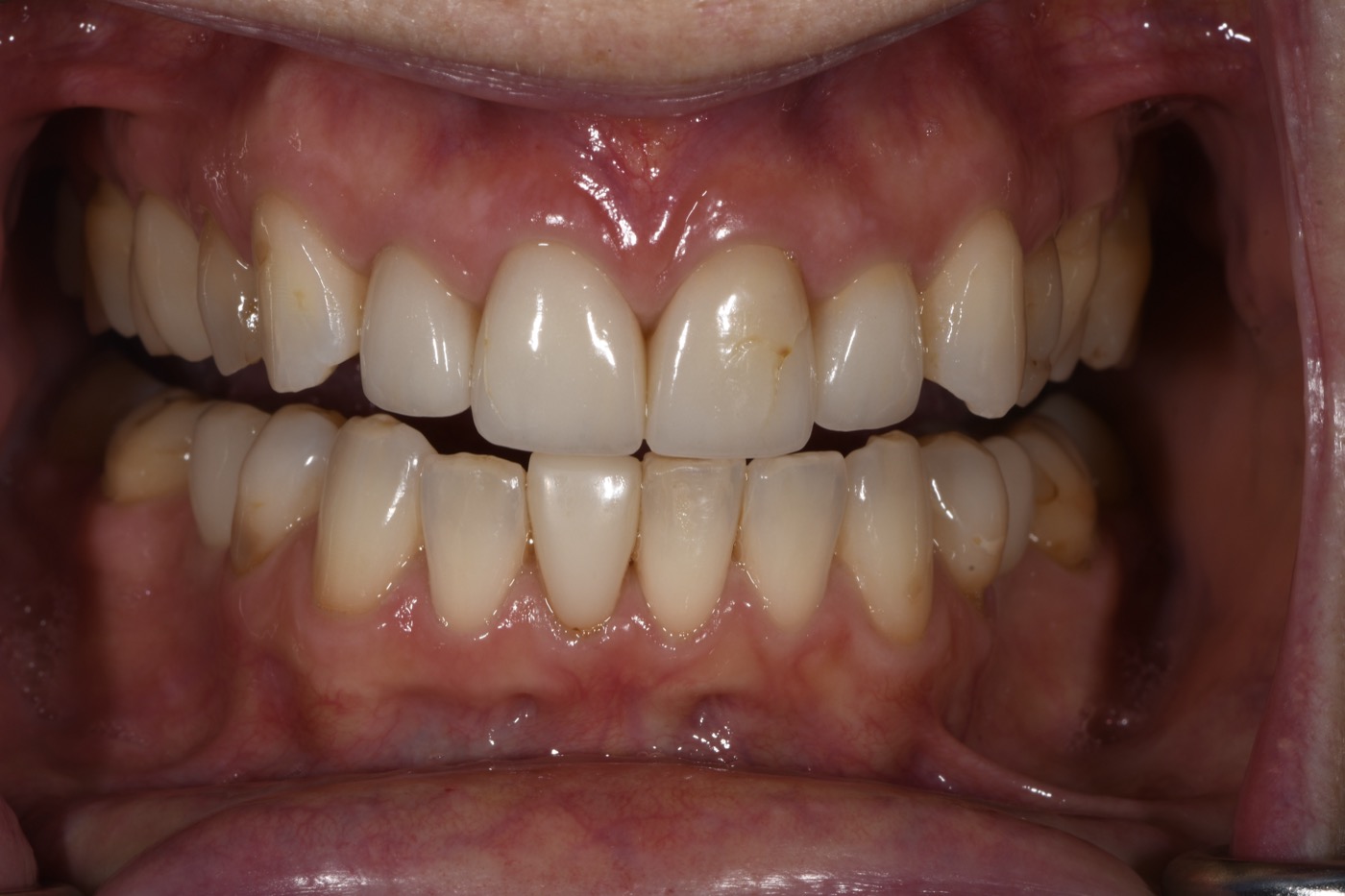 Case 8 before photo 2