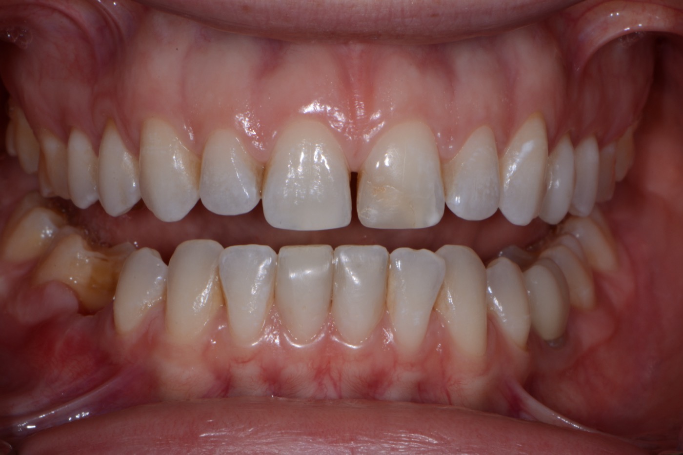 Case 16 before photo 2