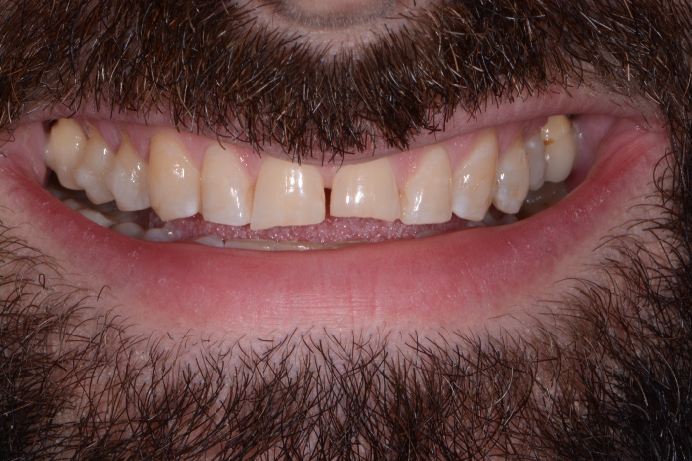 Case 17 before photo 1