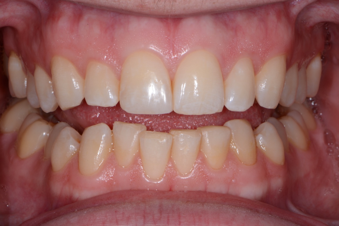 Case 18 after photo 2