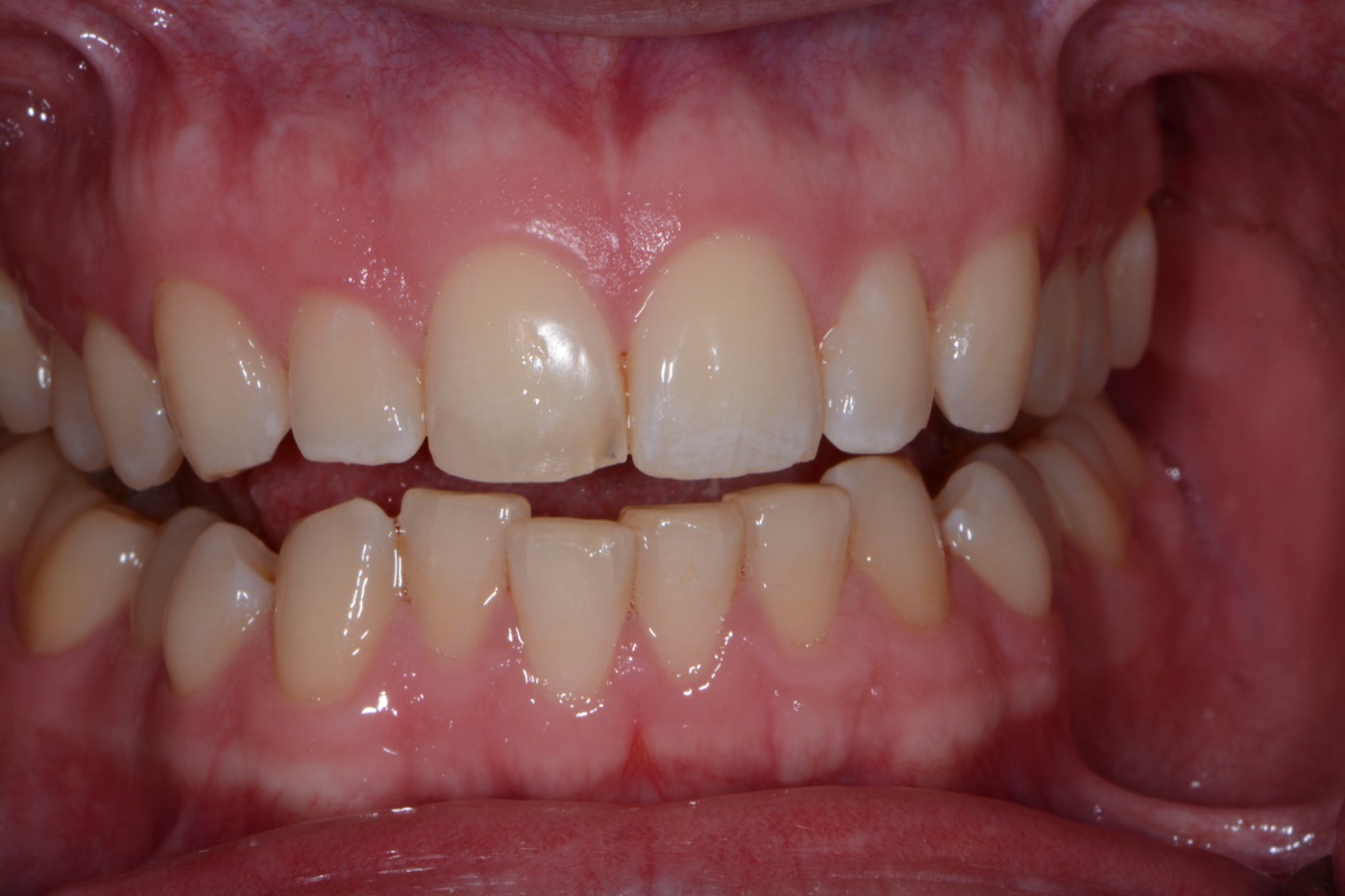 Case 18 before photo 2