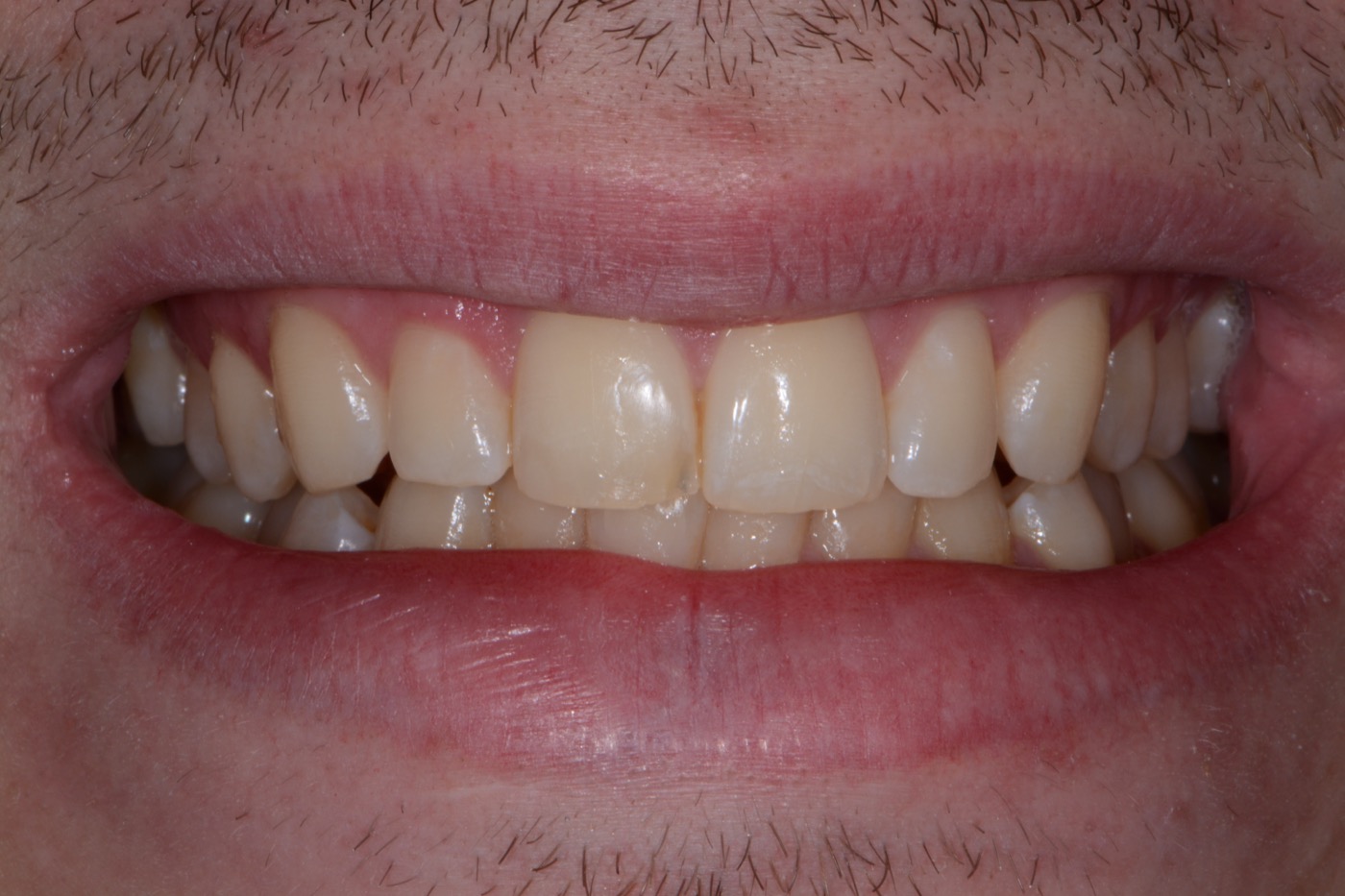 Case 18 before photo 1