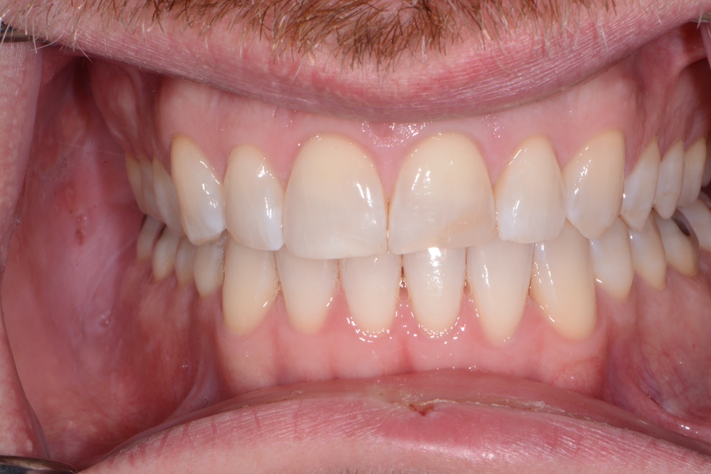 Case 19 before photo 2