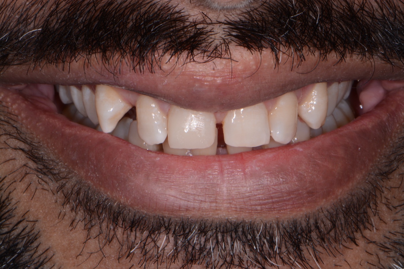 Case 21 after photo 1
