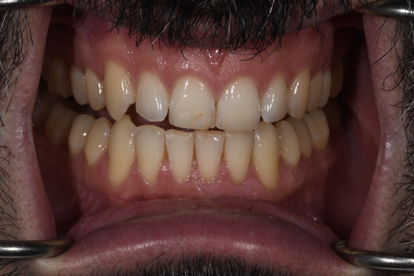 Case 22 before photo 2