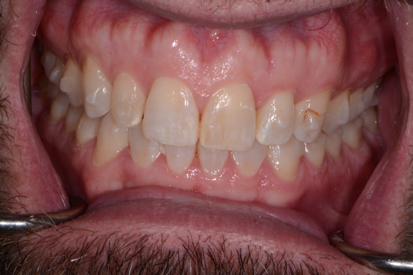 Case 24 before photo 2