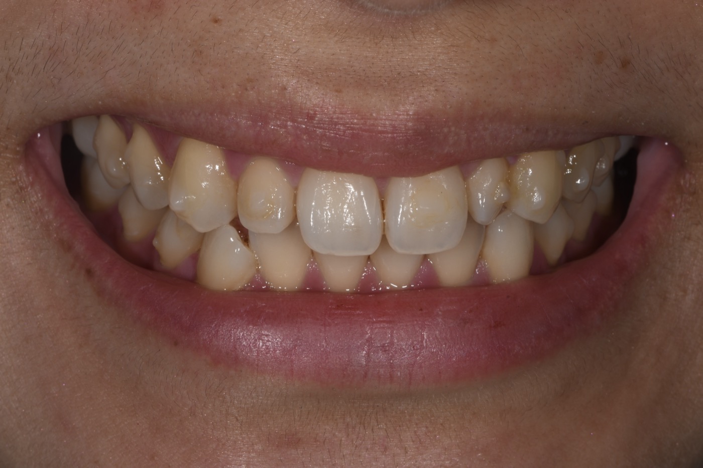 Case 25 before photo 1