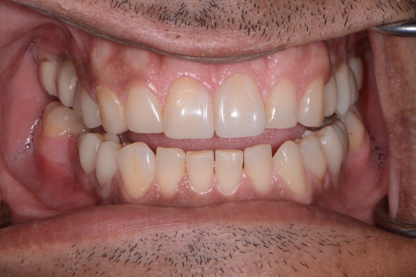 Case 27 after photo 2