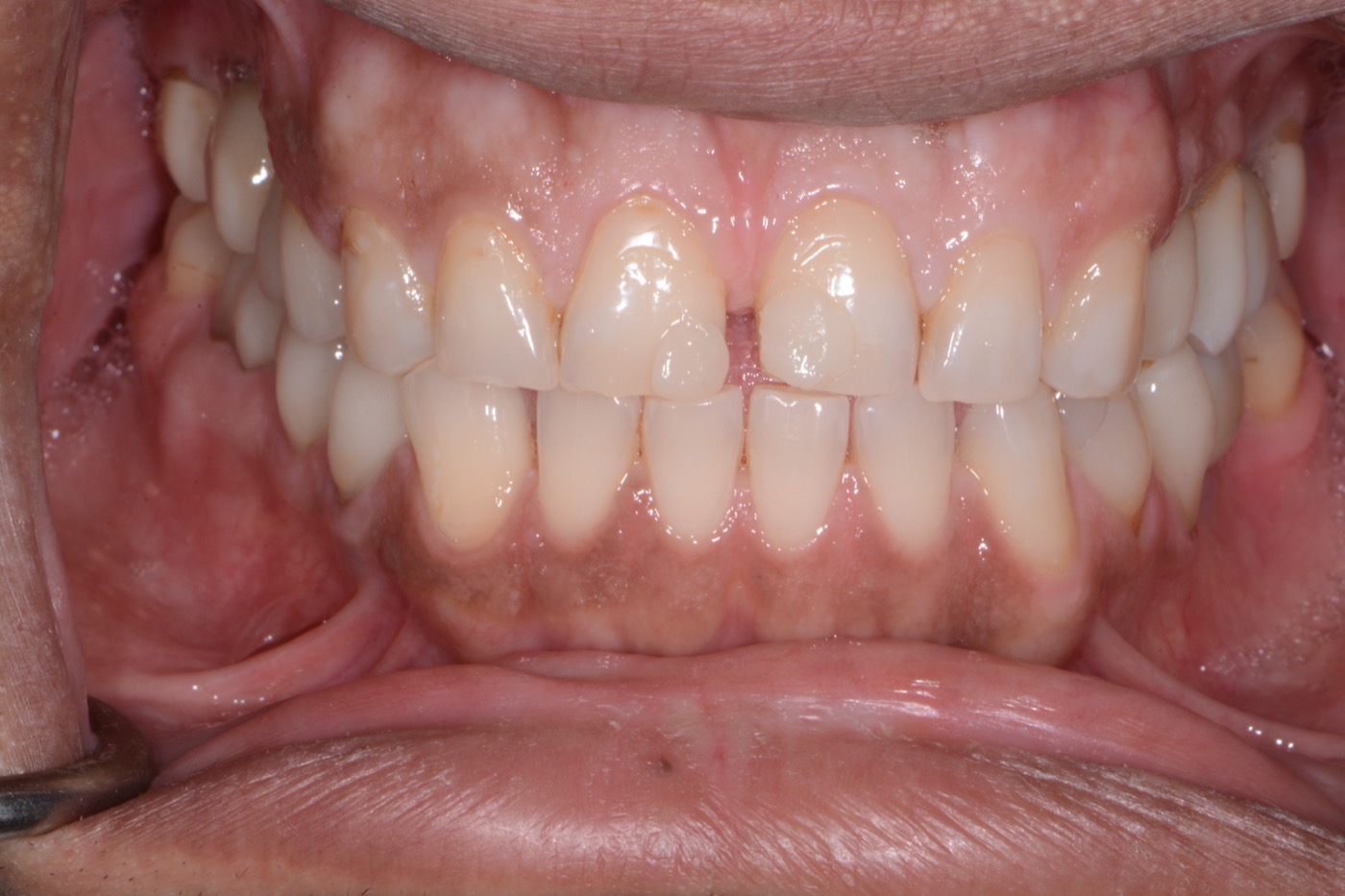 Case 27 before photo 2