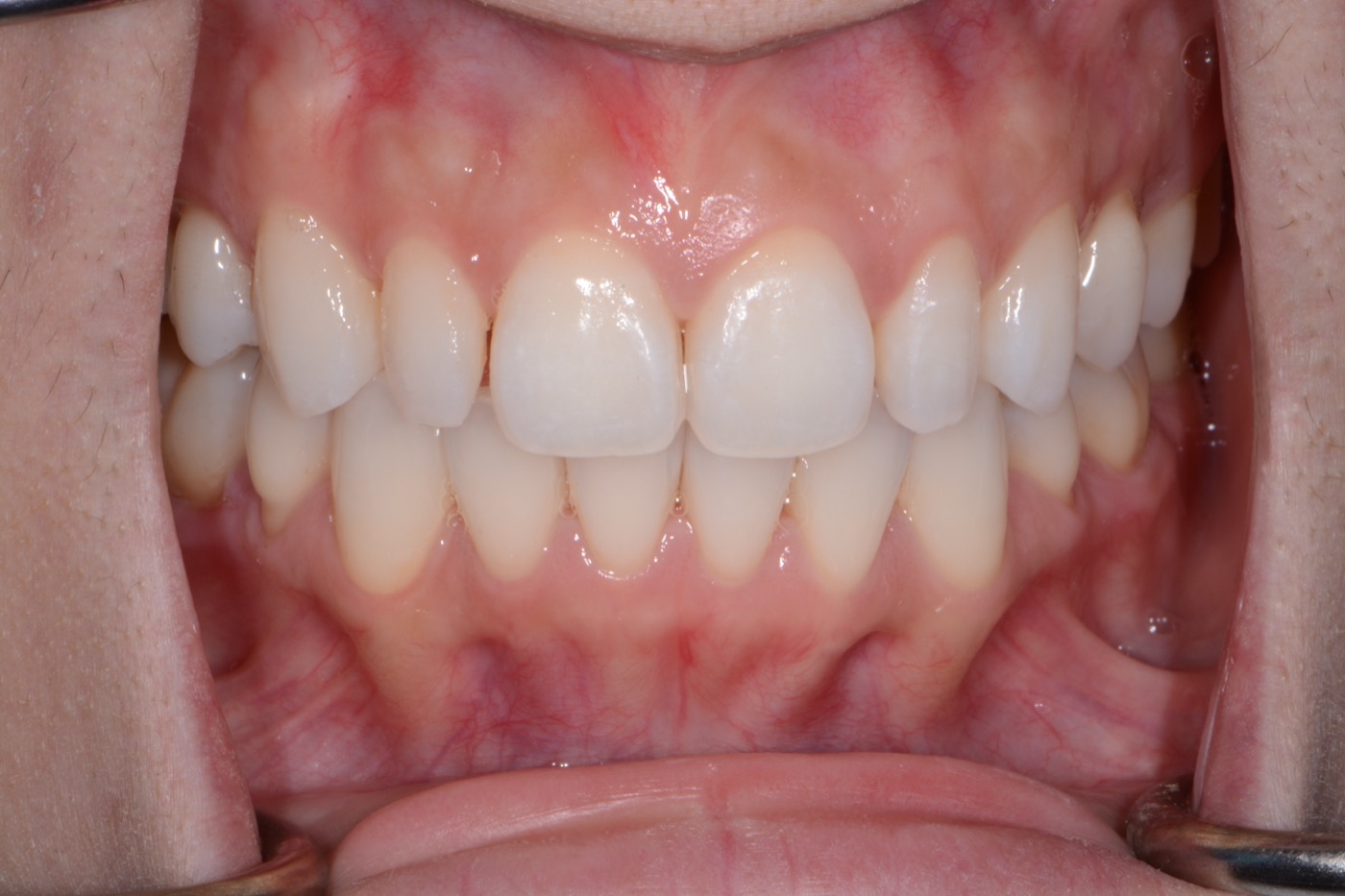 Case 28 before photo 2