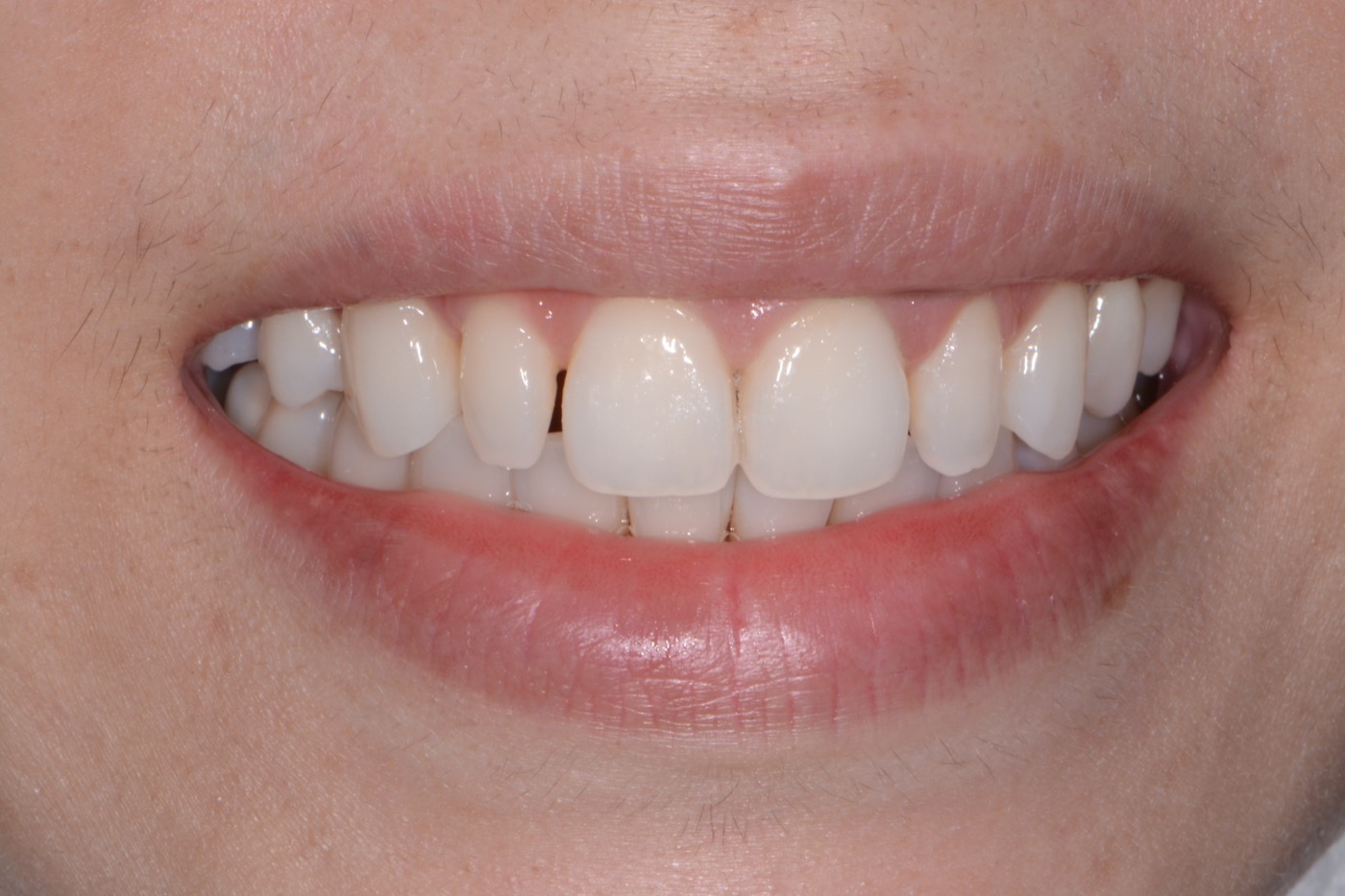 Case 28 before photo 1