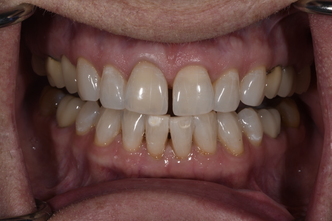 Case 29 before photo 2