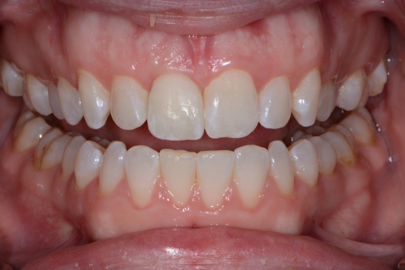 Case 30 after photo 2