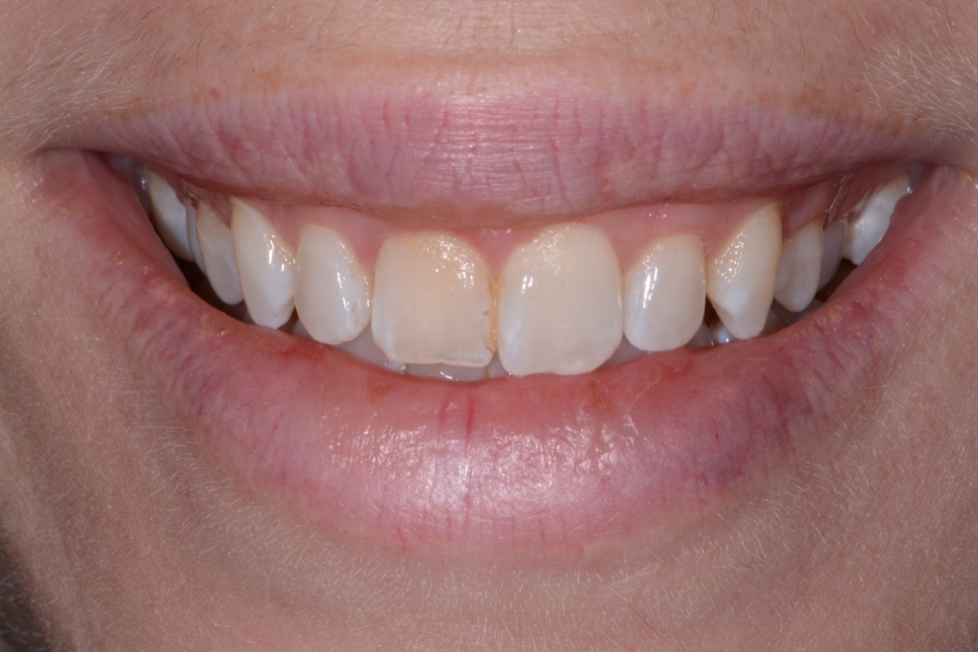 Case 30 before photo 1