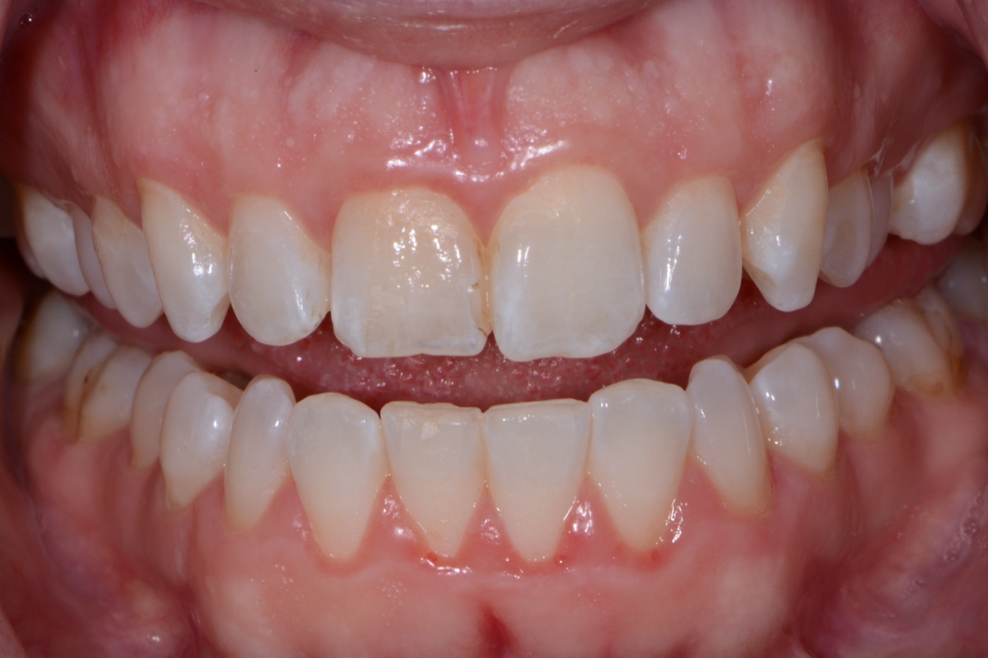 Case 30 before photo 2