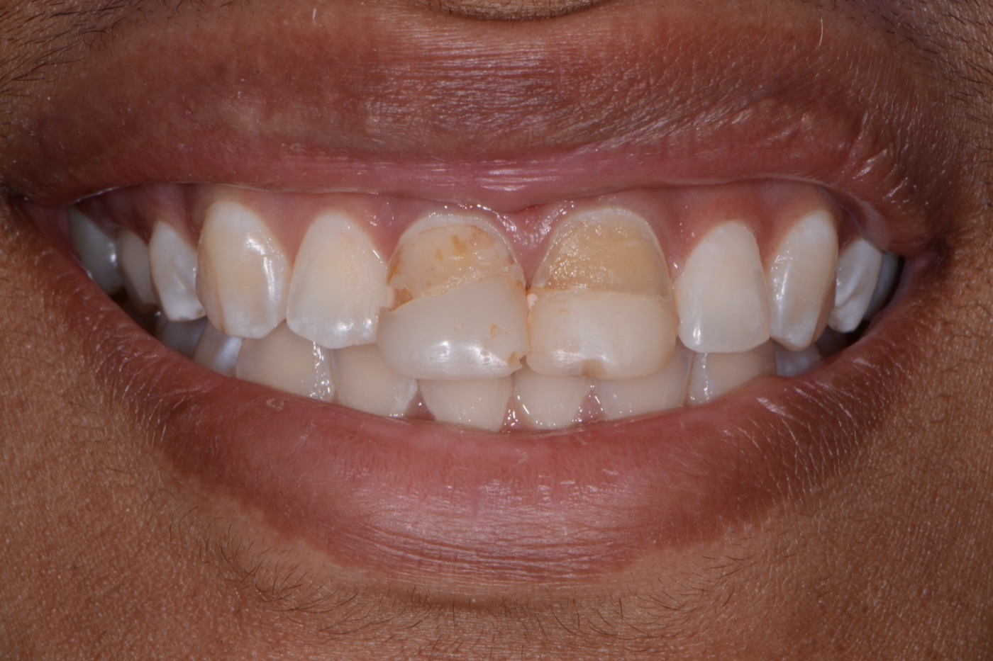 Case 31 before photo 1