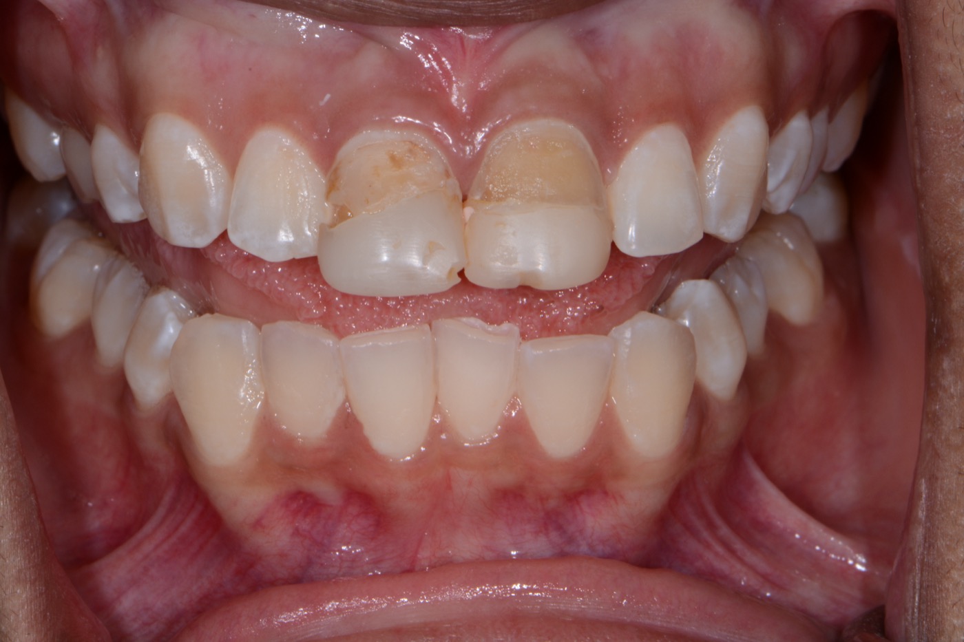Case 31 before photo 2