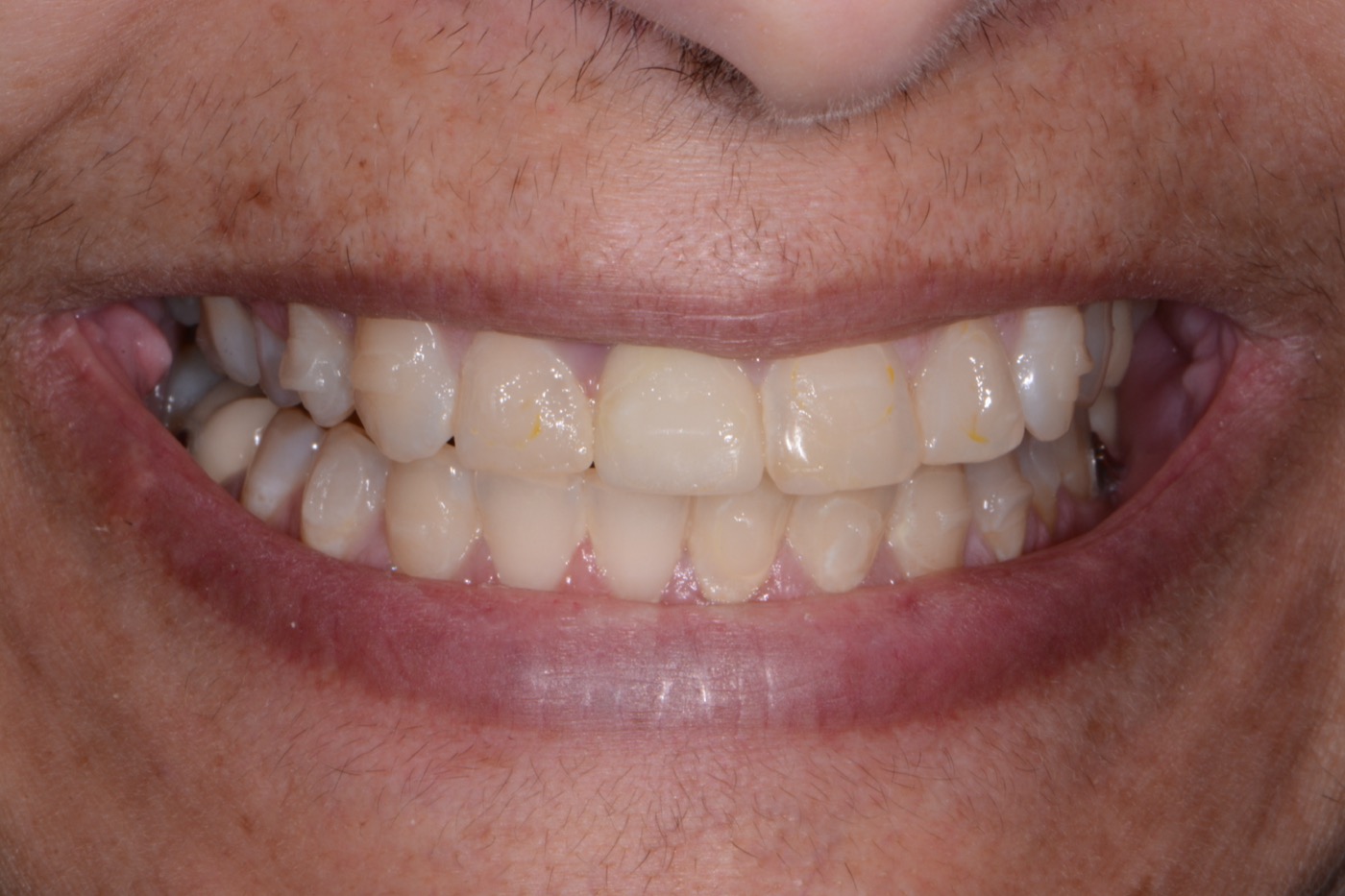 Case 32 before photo 1