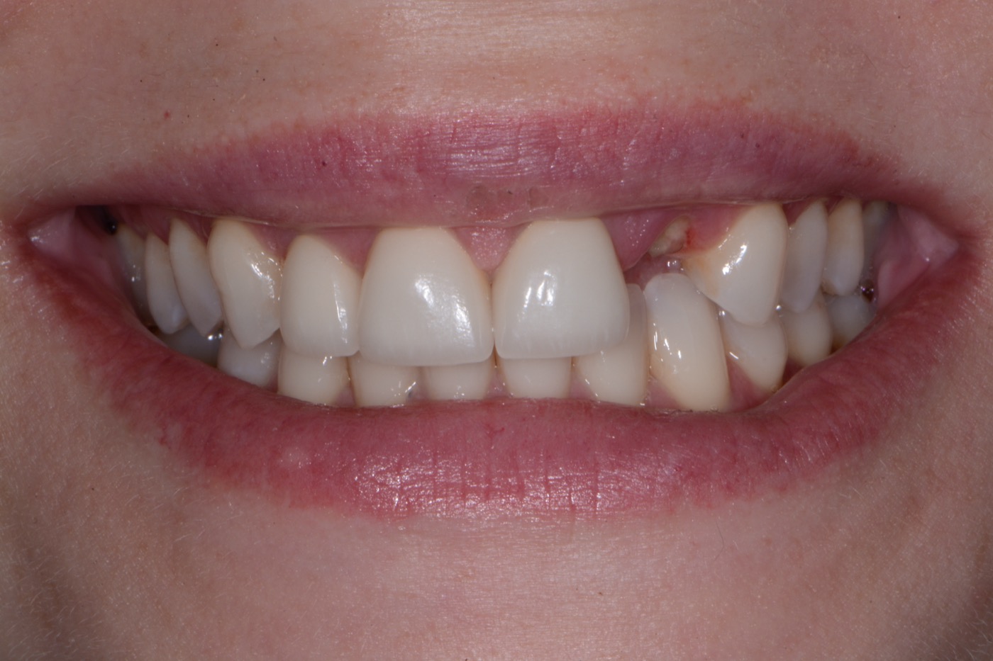 Case 34 before photo 1