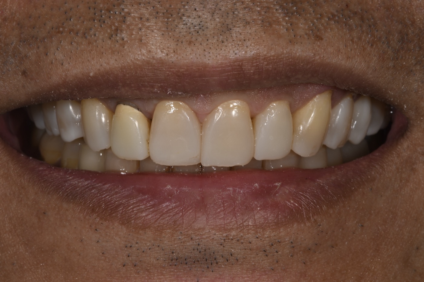 Case 35 before photo 1