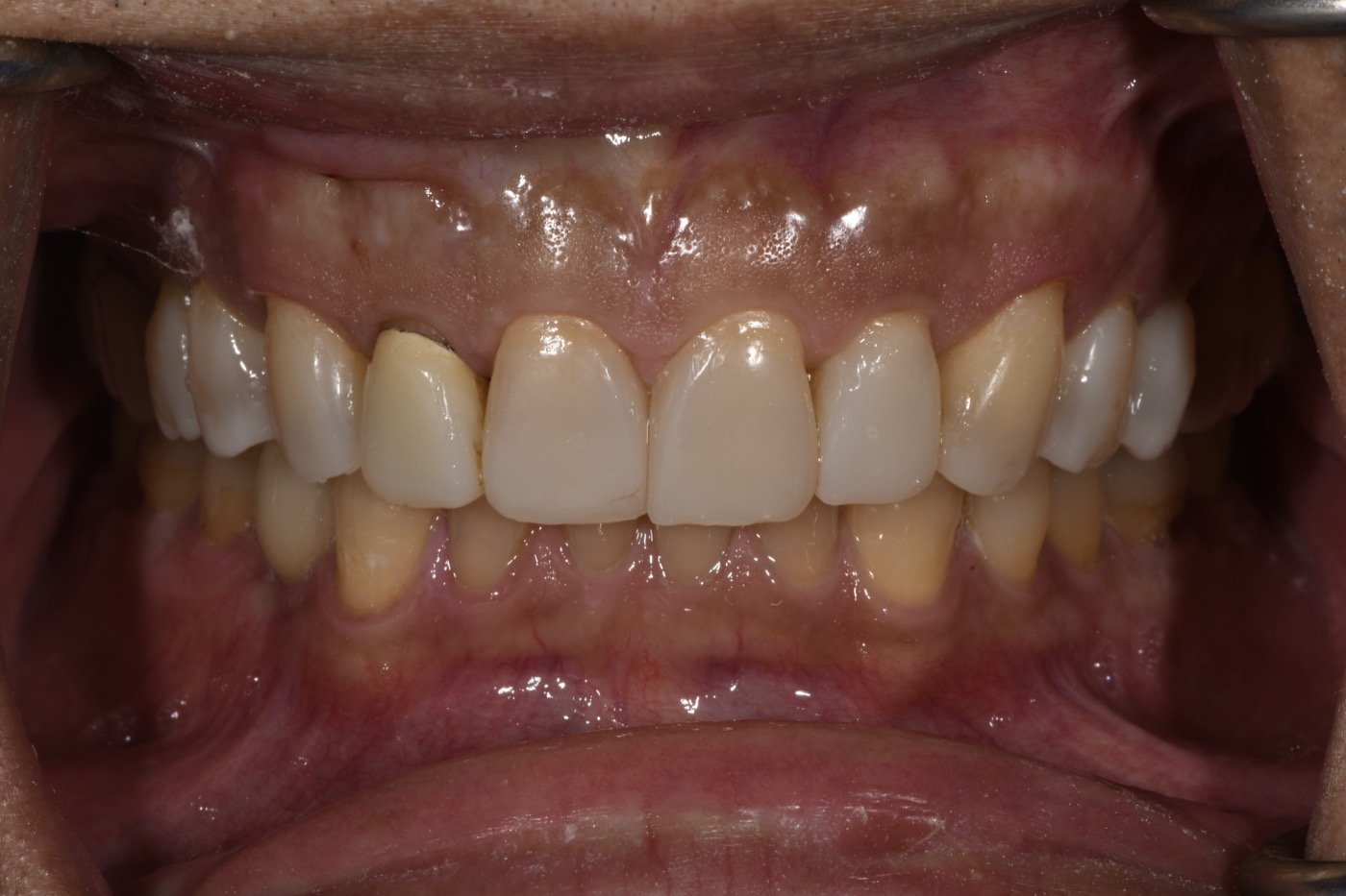 Case 35 before photo 2