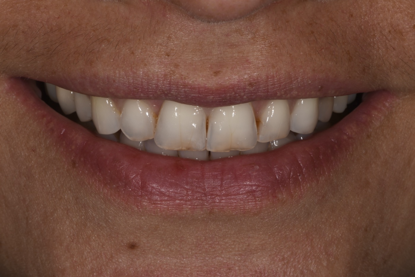 Case 38 before photo 1