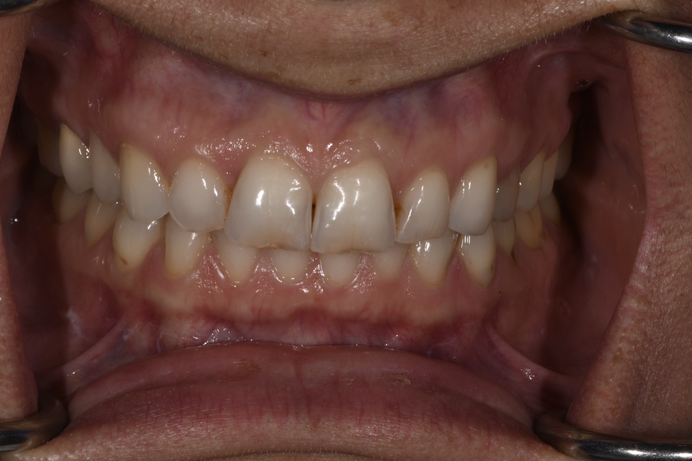 Case 38 before photo 2
