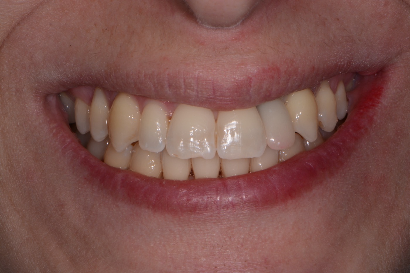 Case 39 before photo 1