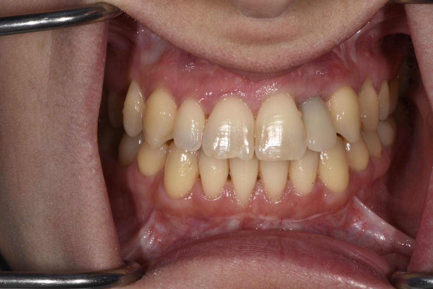 Case 39 before photo 2