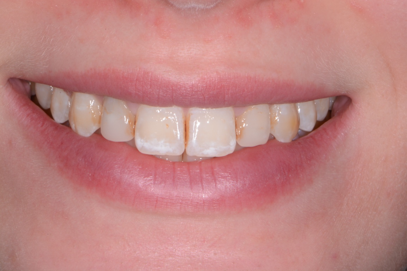 Case 40 before photo 1
