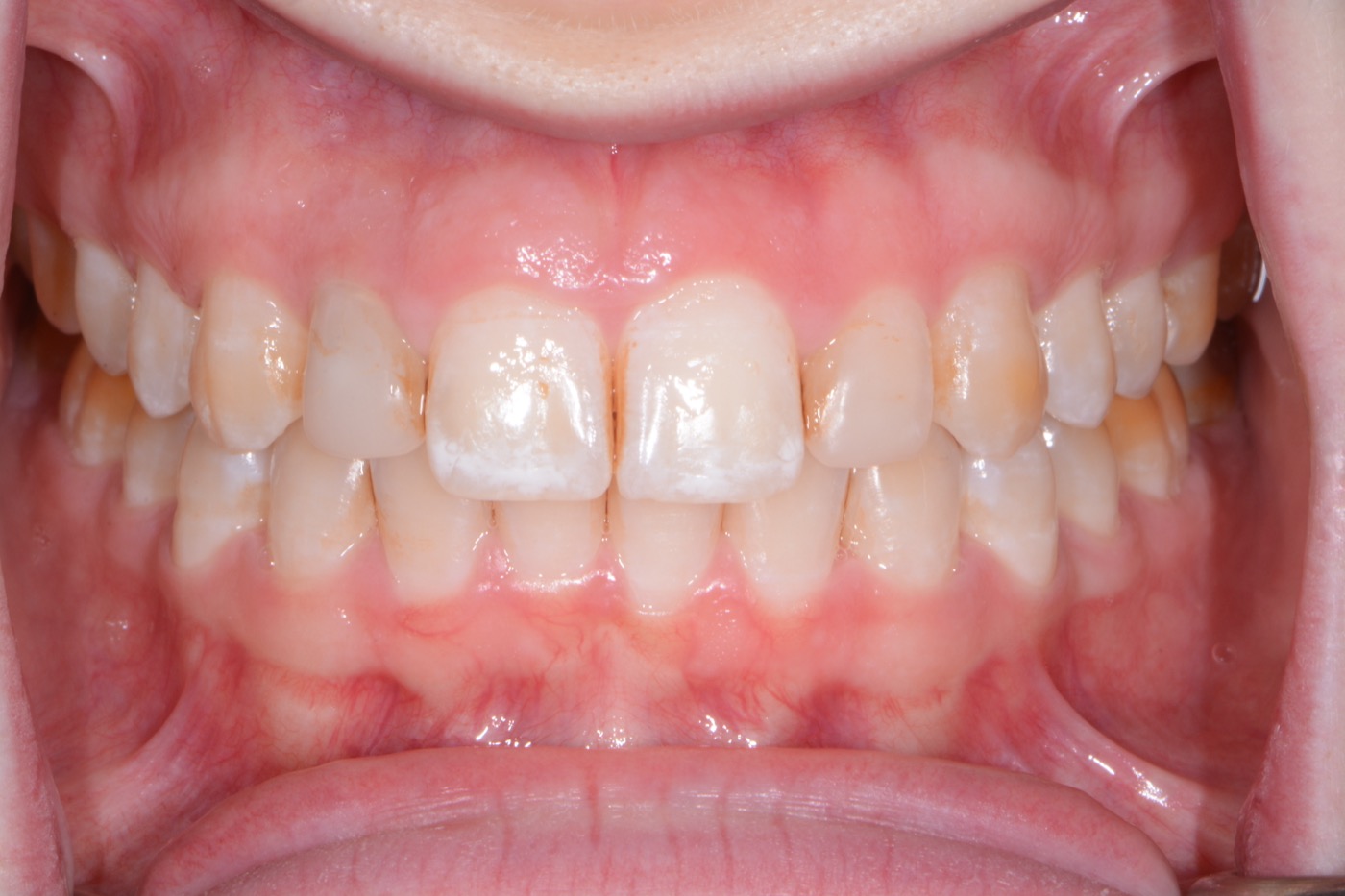 Case 40 before photo 2