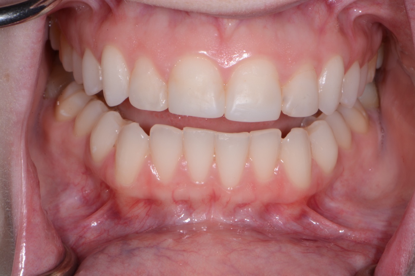 Case 41 before photo 2