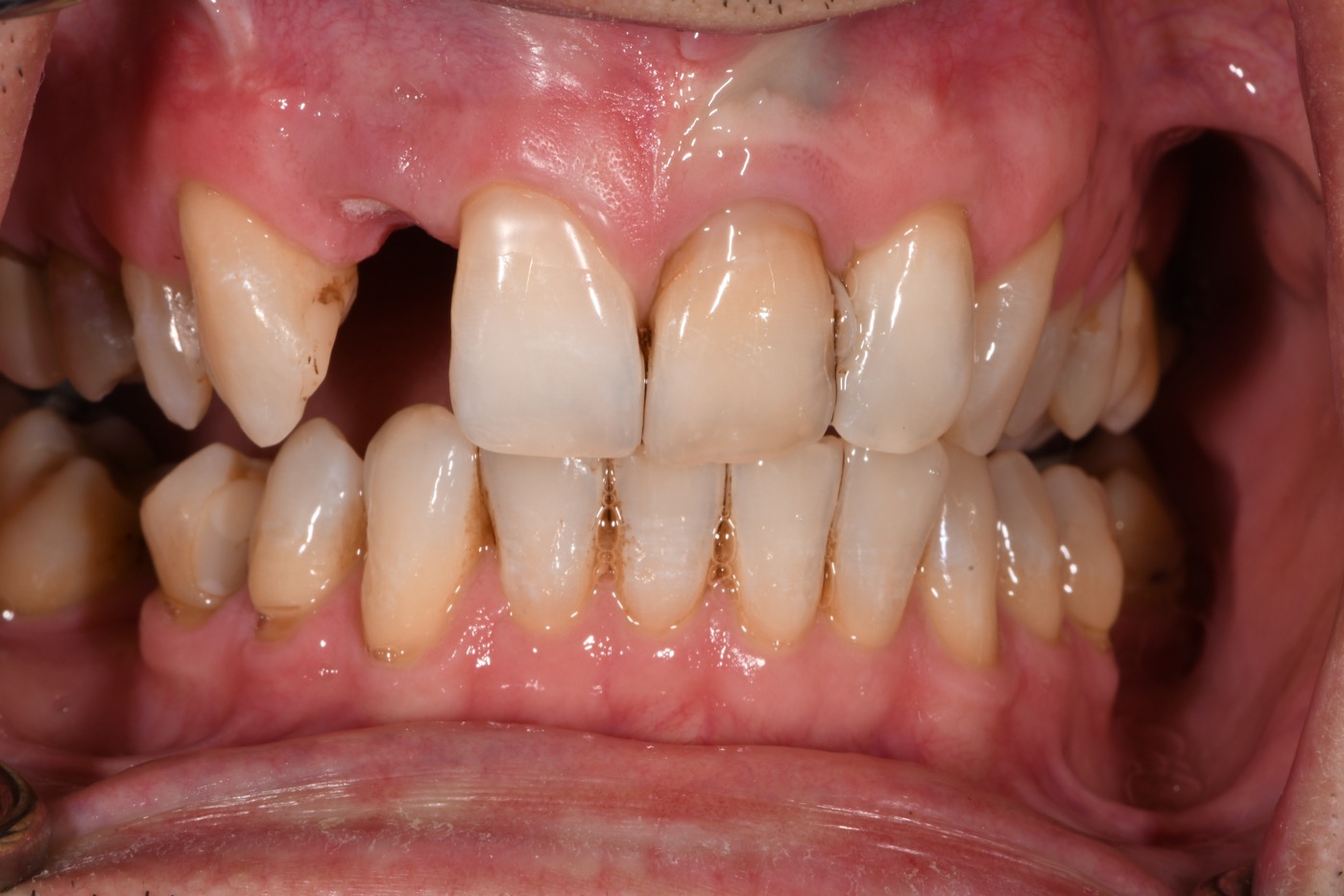 Case 42 before photo 2