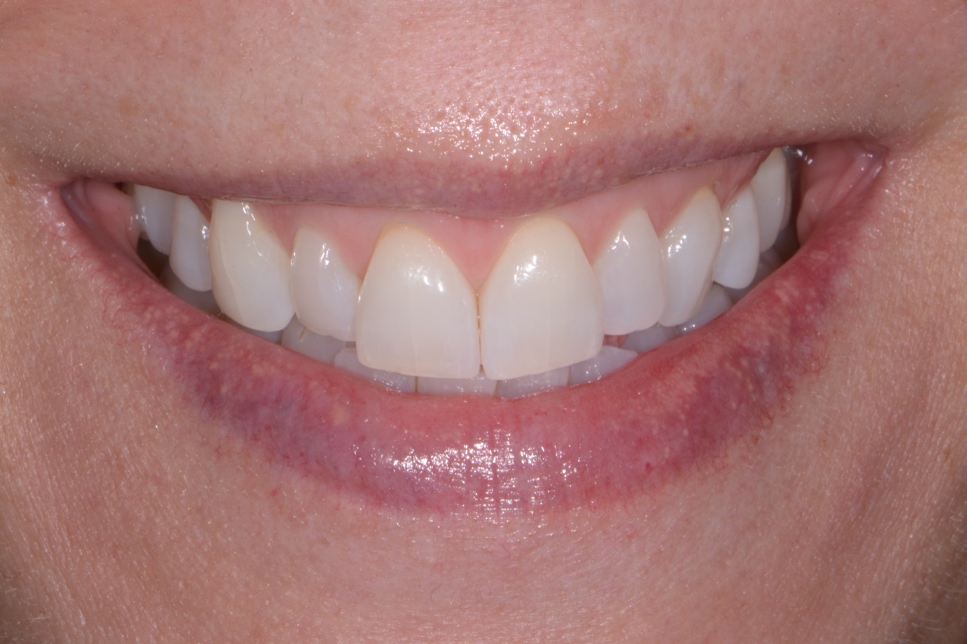 Case 45 before photo 1