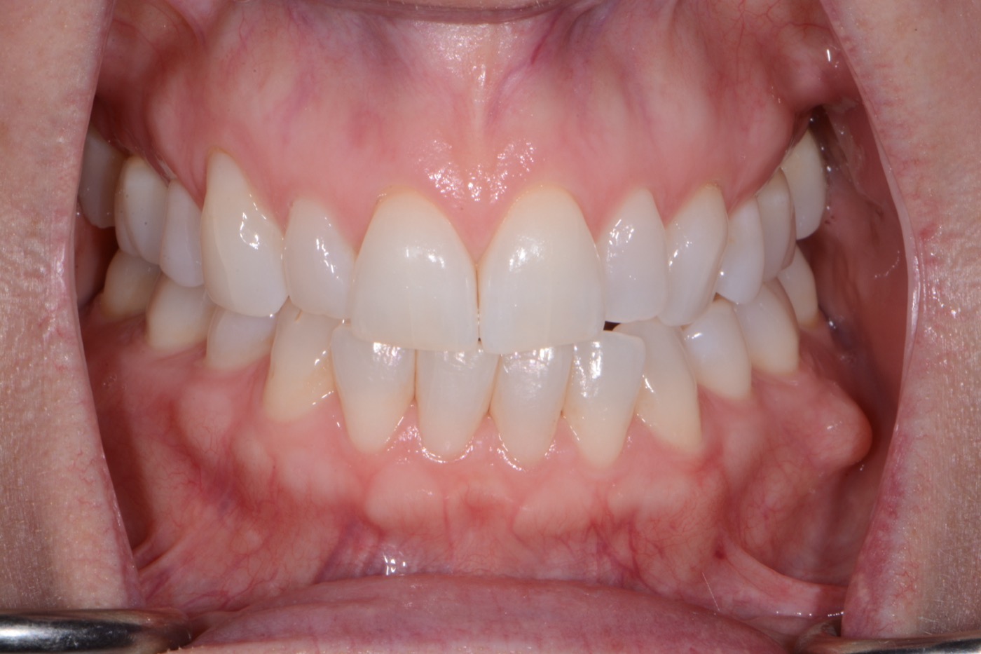 Case 45 before photo 2