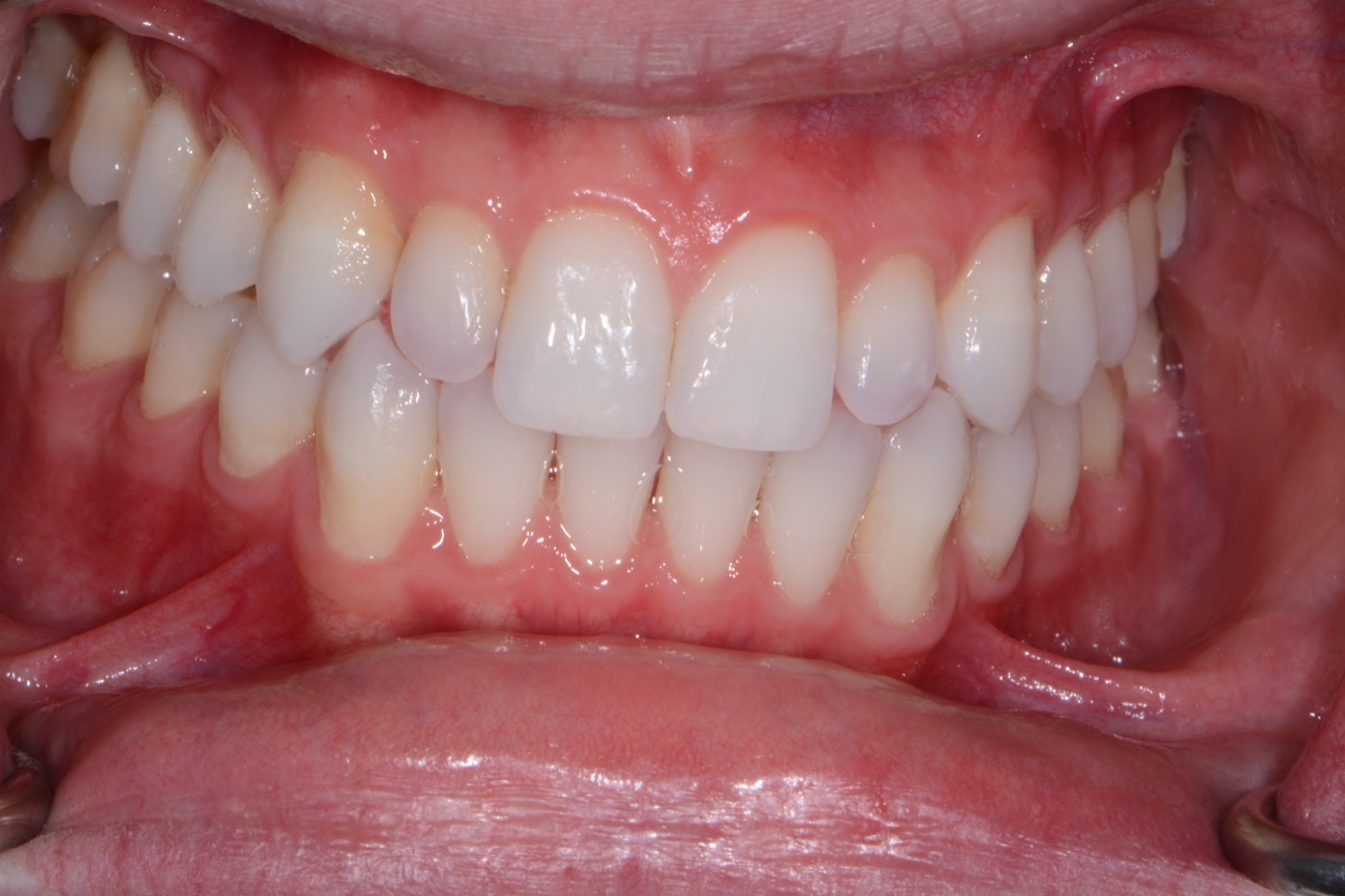 Case 47 before photo 2