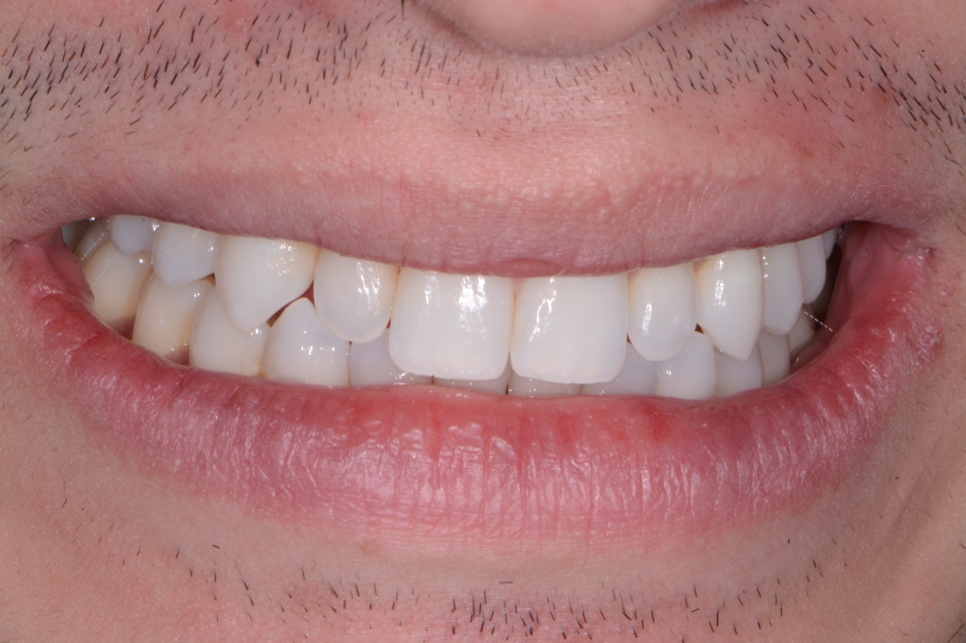 Case 47 before photo 1