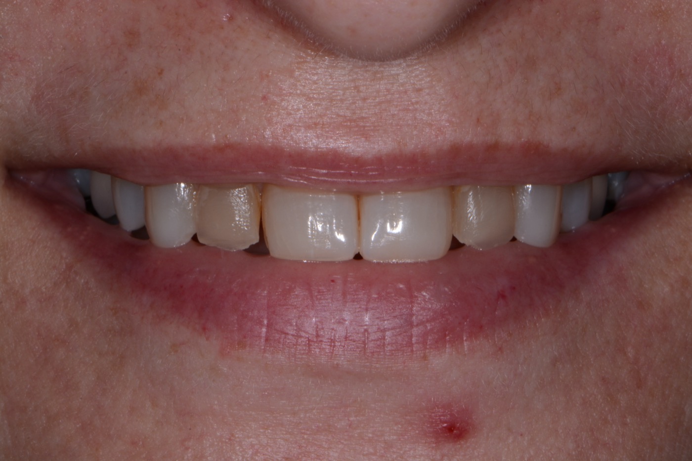 Case 48 before photo 1